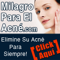 Milagro para el acné: Lucas David Serrano leyó opiniones para eliminar las espinillas del acné